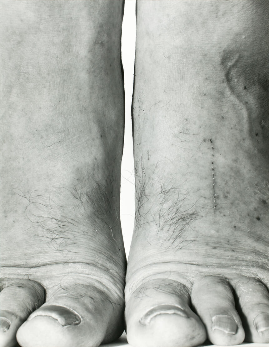 Self-Portrait: Feet Frontal. Artist: John R. Coplans. Date: 1984. Medium: gelatin silver print.